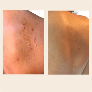 Mist-my-Skin Face and Body Spray with Hypochlorous Acid